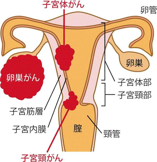 子宮
