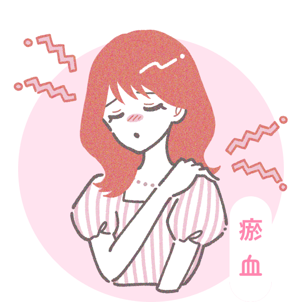 瘀血のイメージ
